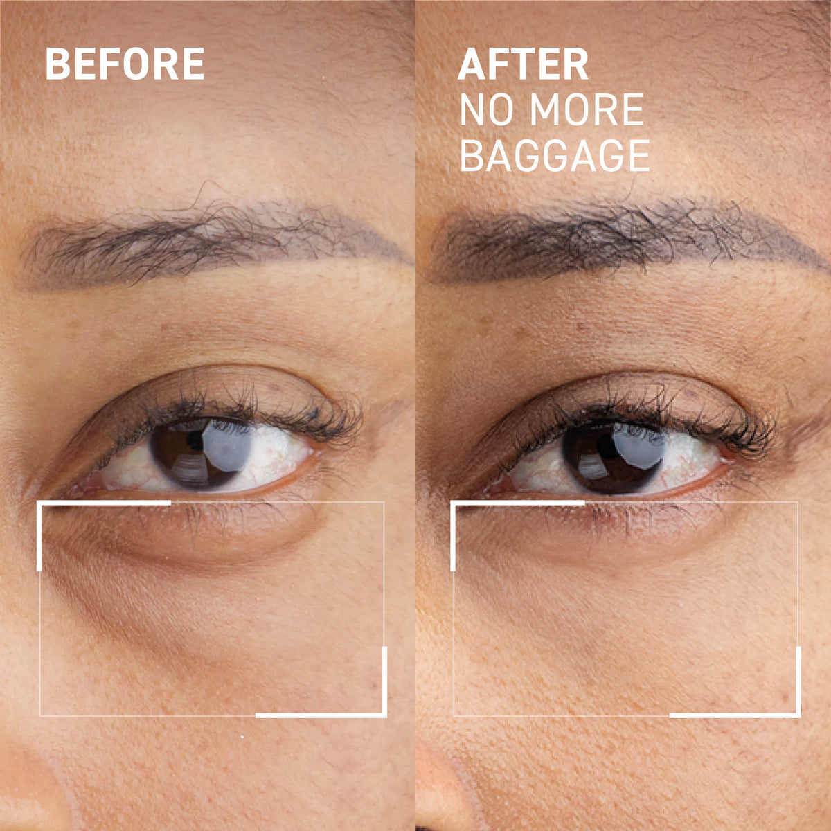 Reviewers 'Can't Believe' How Quickly This Eye Gel Tones Down Bags