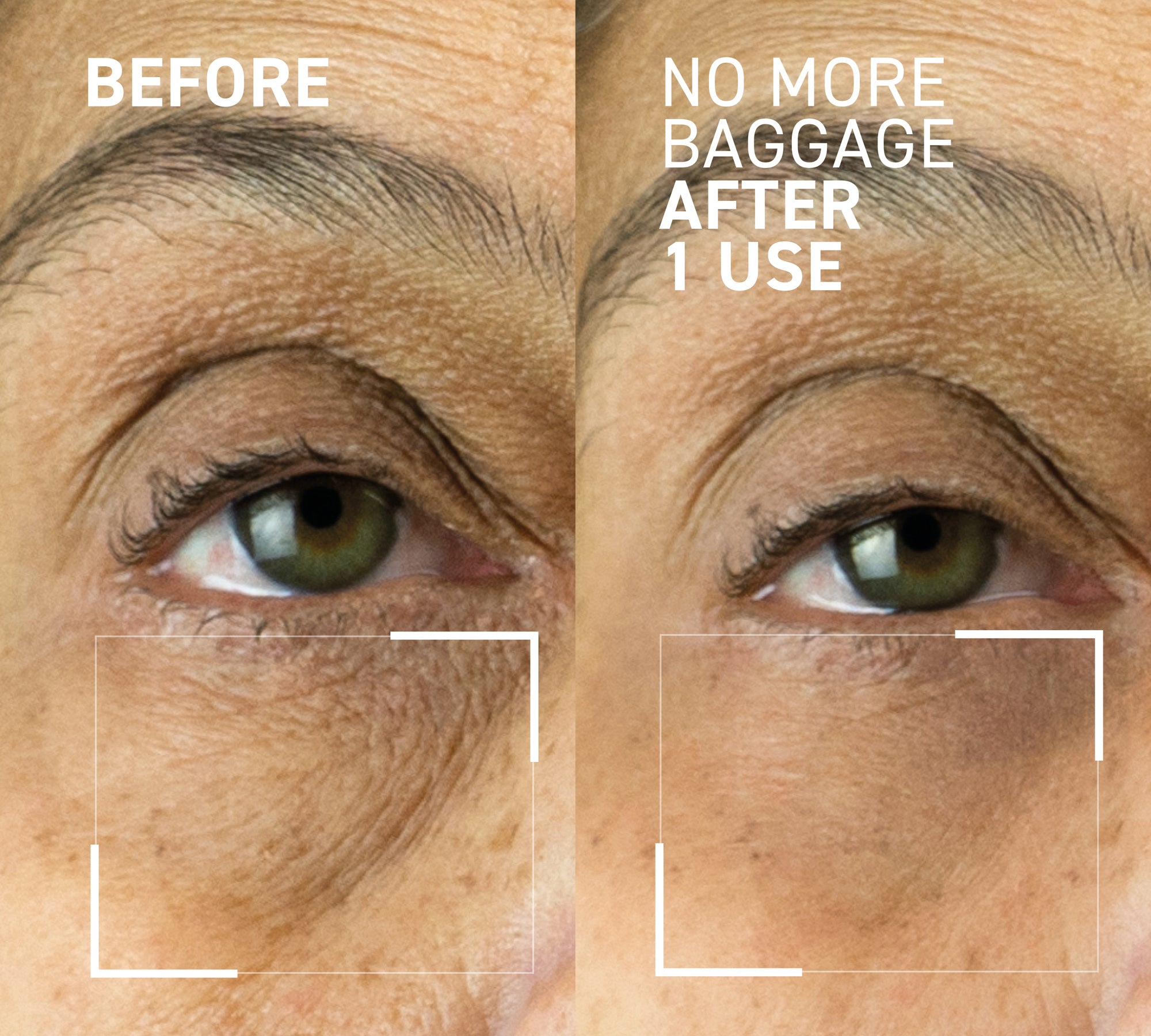 Best Eye Cream Skincare for Aging Undereyes