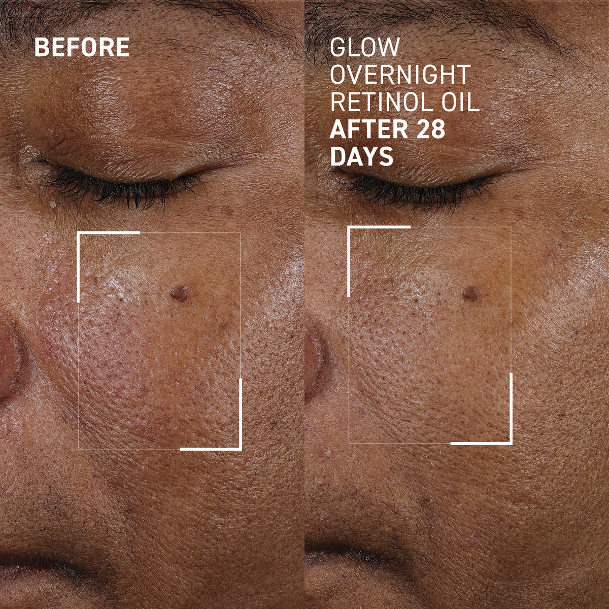 GLOW OVERNIGHT RETINOL OIL™