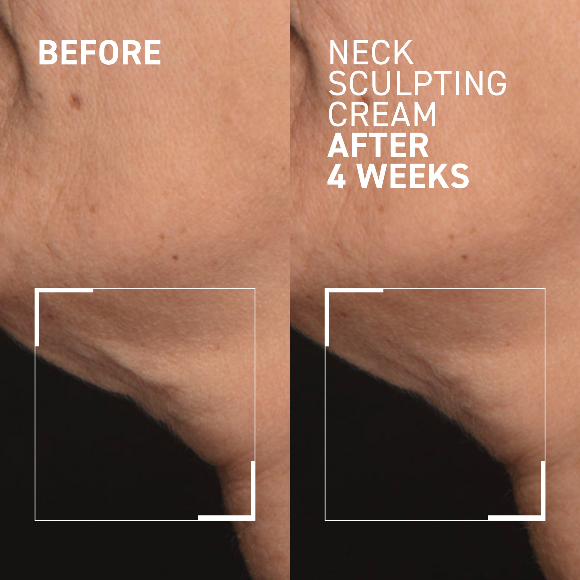 Dr. Brandt Skincare Needles No More® Neck Sculpting Cream Review