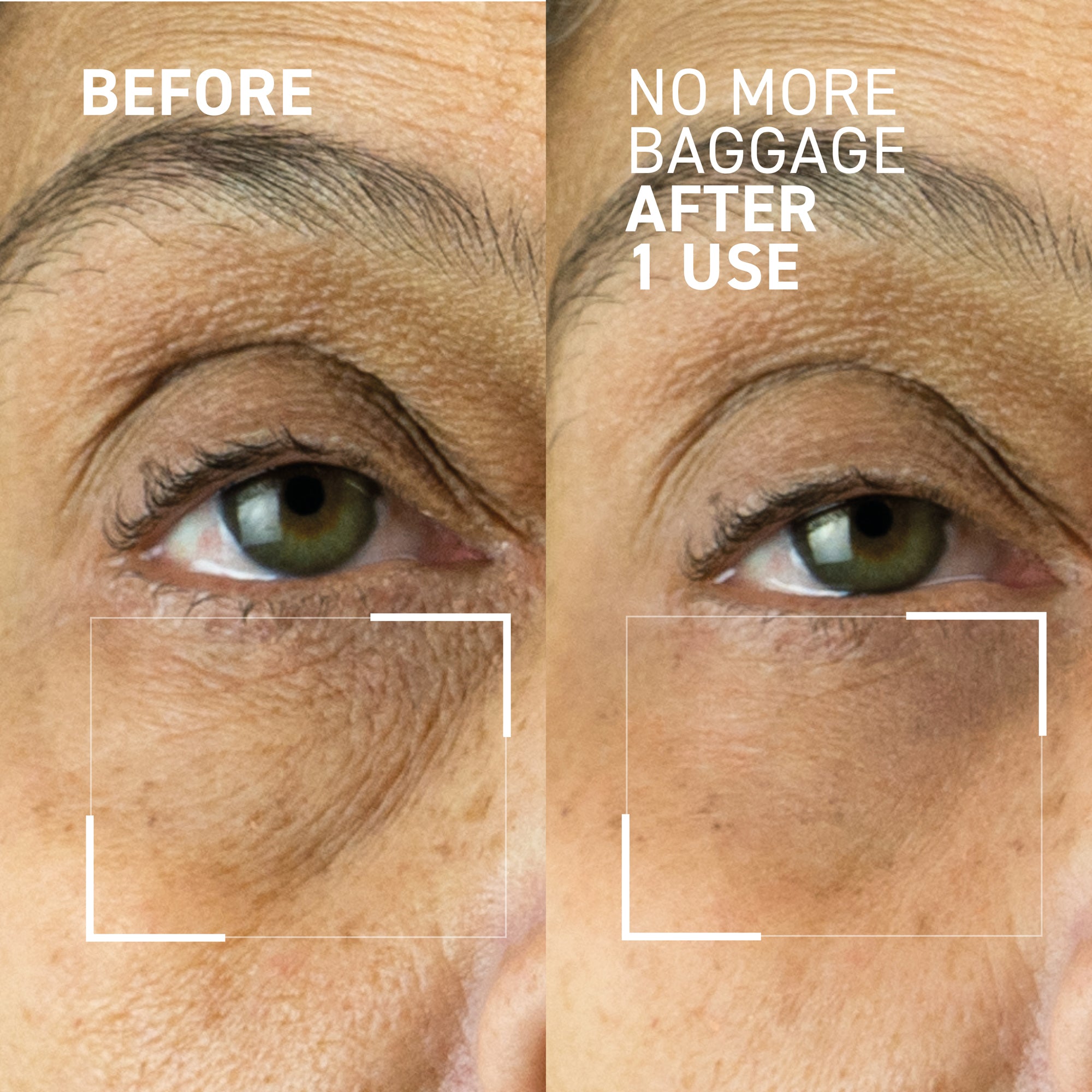 How To Use No More Baggage Eye Depuffing Gel: dr. brandt skincare